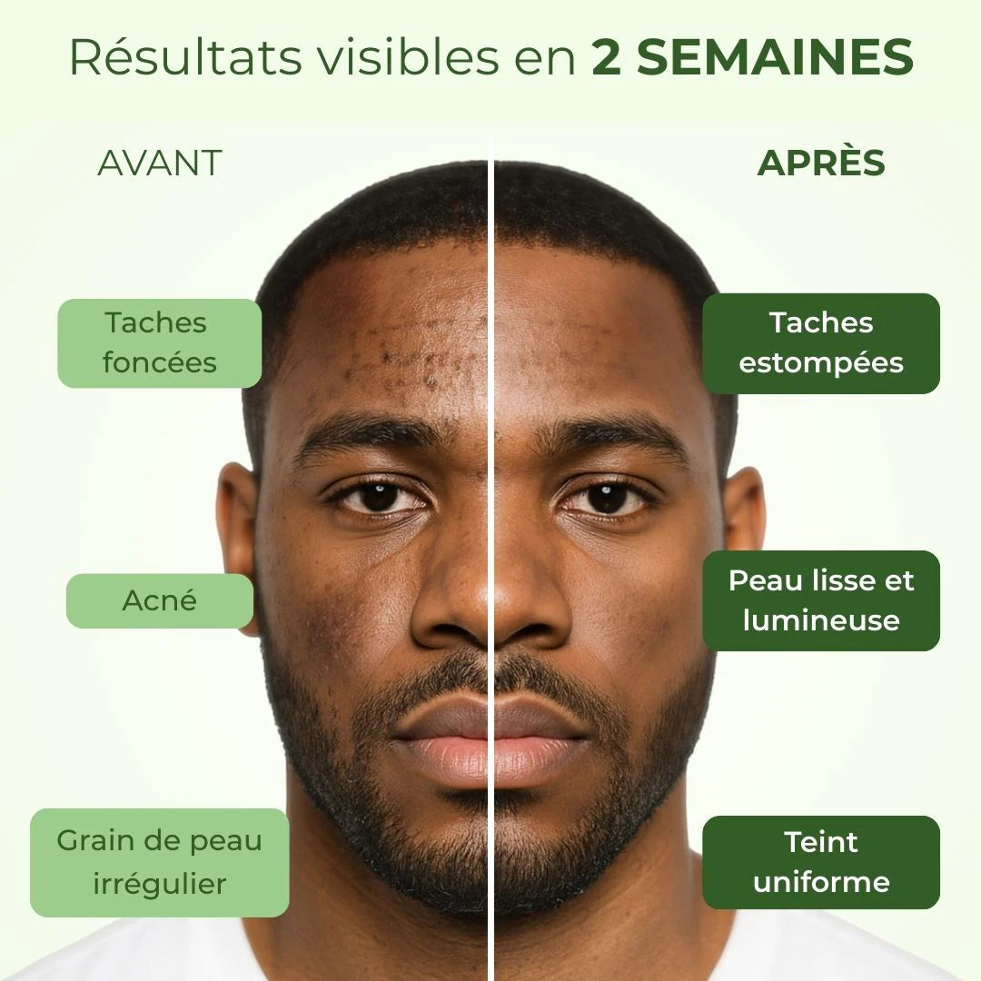 Savon Éclat au Curcuma