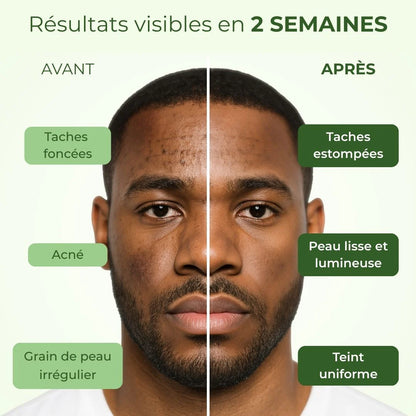 Savon Éclat au Curcuma