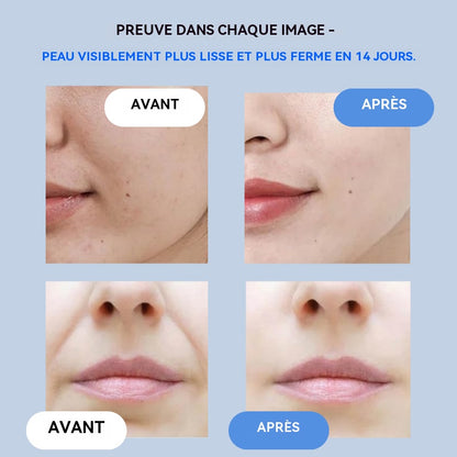 AgeErase™ | Les produits anti-rides utilisés en secret par les célébrités hollywoodiennes