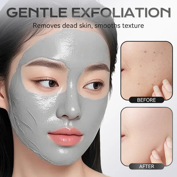 Masque à l'argile à l'acide azélaïque en stick de 40 g