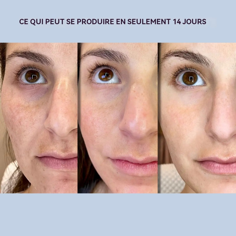 AgeErase™ | Les produits anti-rides utilisés en secret par les célébrités hollywoodiennes