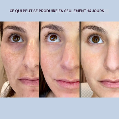 AgeErase™ | Les produits anti-rides utilisés en secret par les célébrités hollywoodiennes