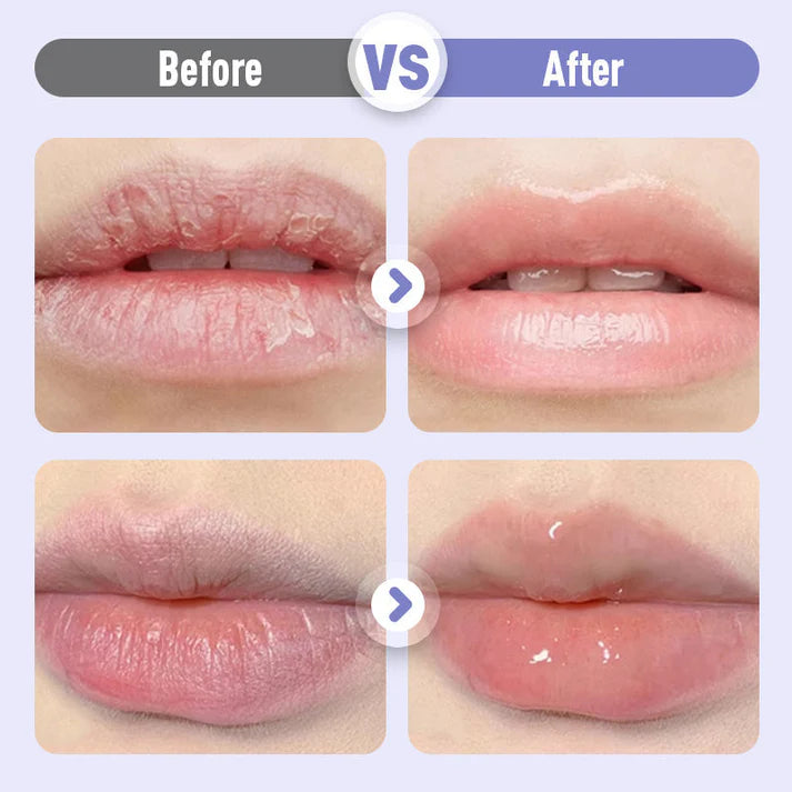 Sérum Hydratant Repulpant et Anti-Rides pour les Lèvres💋Oferta por tempo limitado: compre um e ganhe outro grátis
