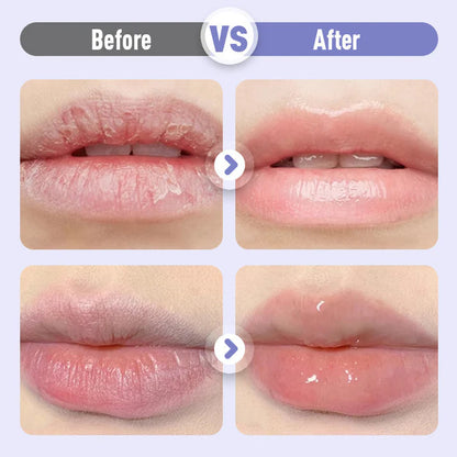 Sérum Hydratant Repulpant et Anti-Rides pour les Lèvres💋Oferta por tempo limitado: compre um e ganhe outro grátis