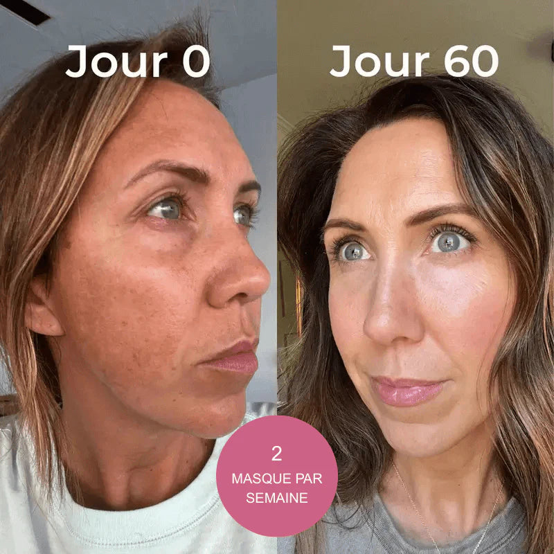 Masque coréen au bio-collagène SoilBoost