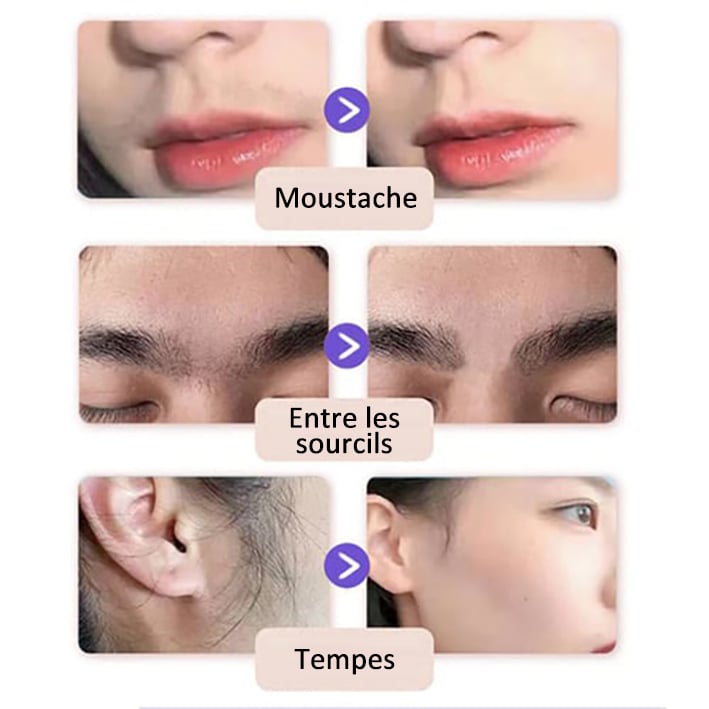 Vente du dernier jour 50% de réduction | SoilBoost™ Crème dépilatoire douce et indolore pour le visage