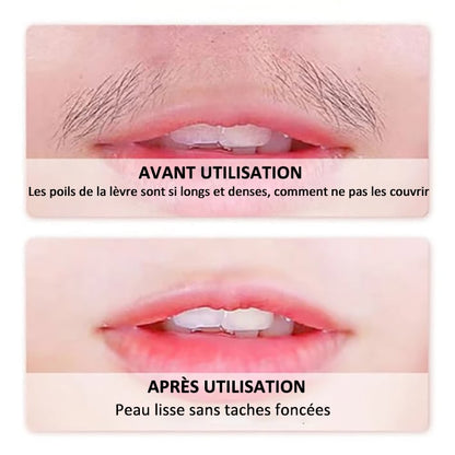 Vente du dernier jour 50% de réduction | SoilBoost™ Crème dépilatoire douce et indolore pour le visage