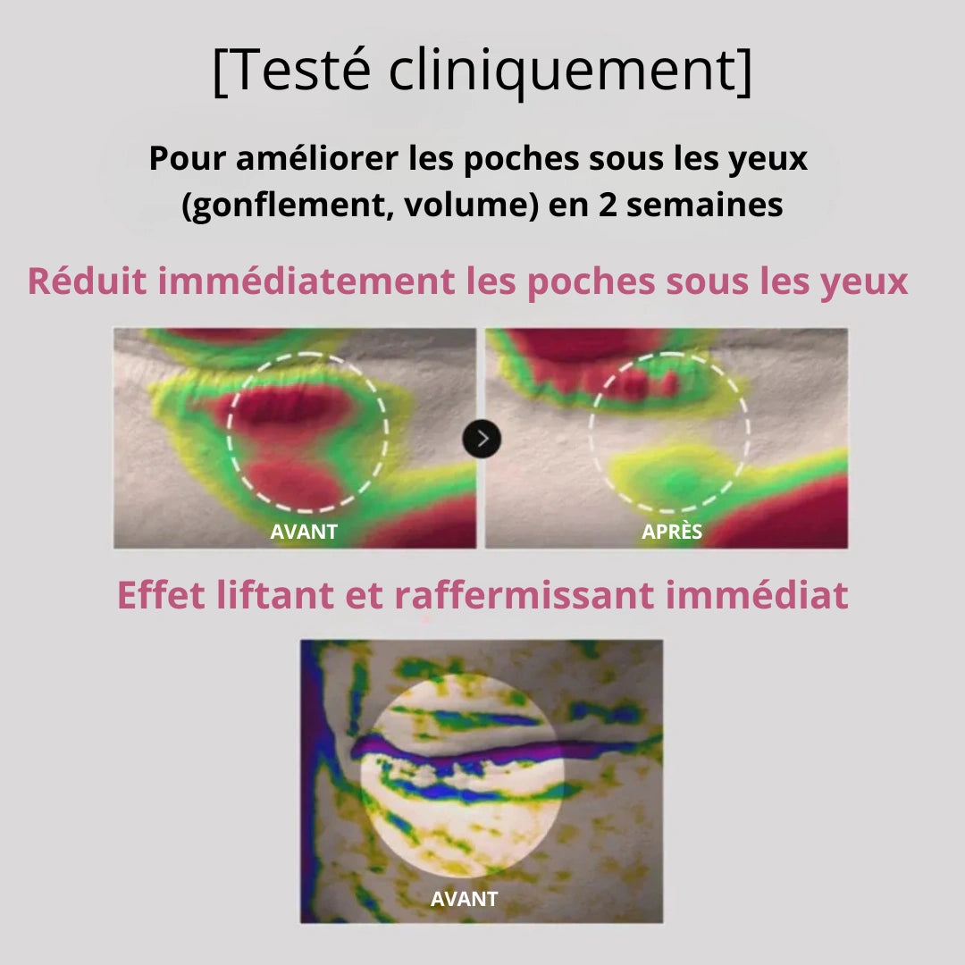 Patchs hydrogel SoilBoost au collagène et aux peptides