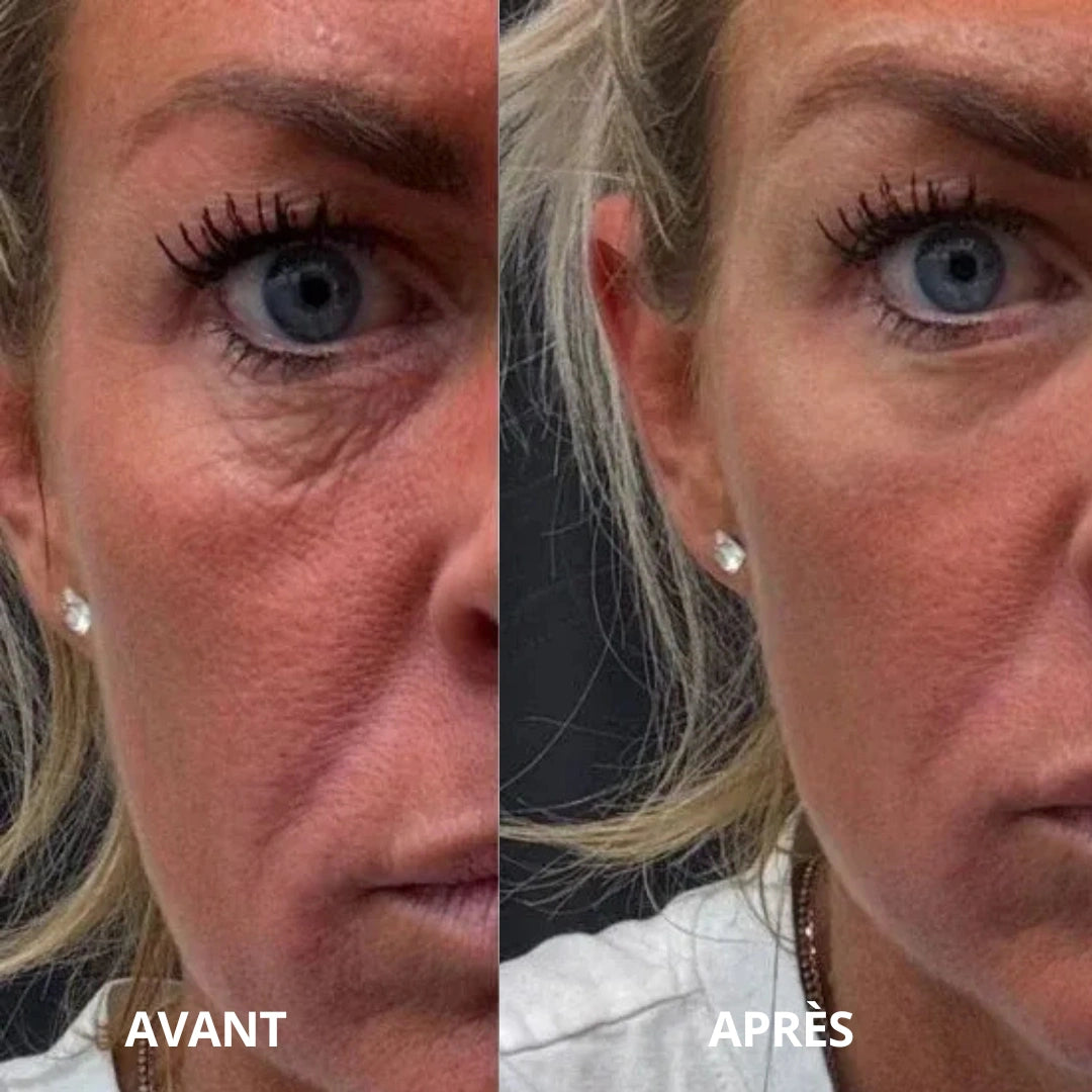 Patchs hydrogel SoilBoost au collagène et aux peptides