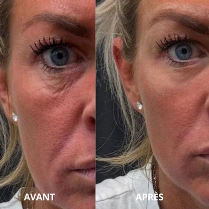 Patchs hydrogel SoilBoost au collagène et aux peptides