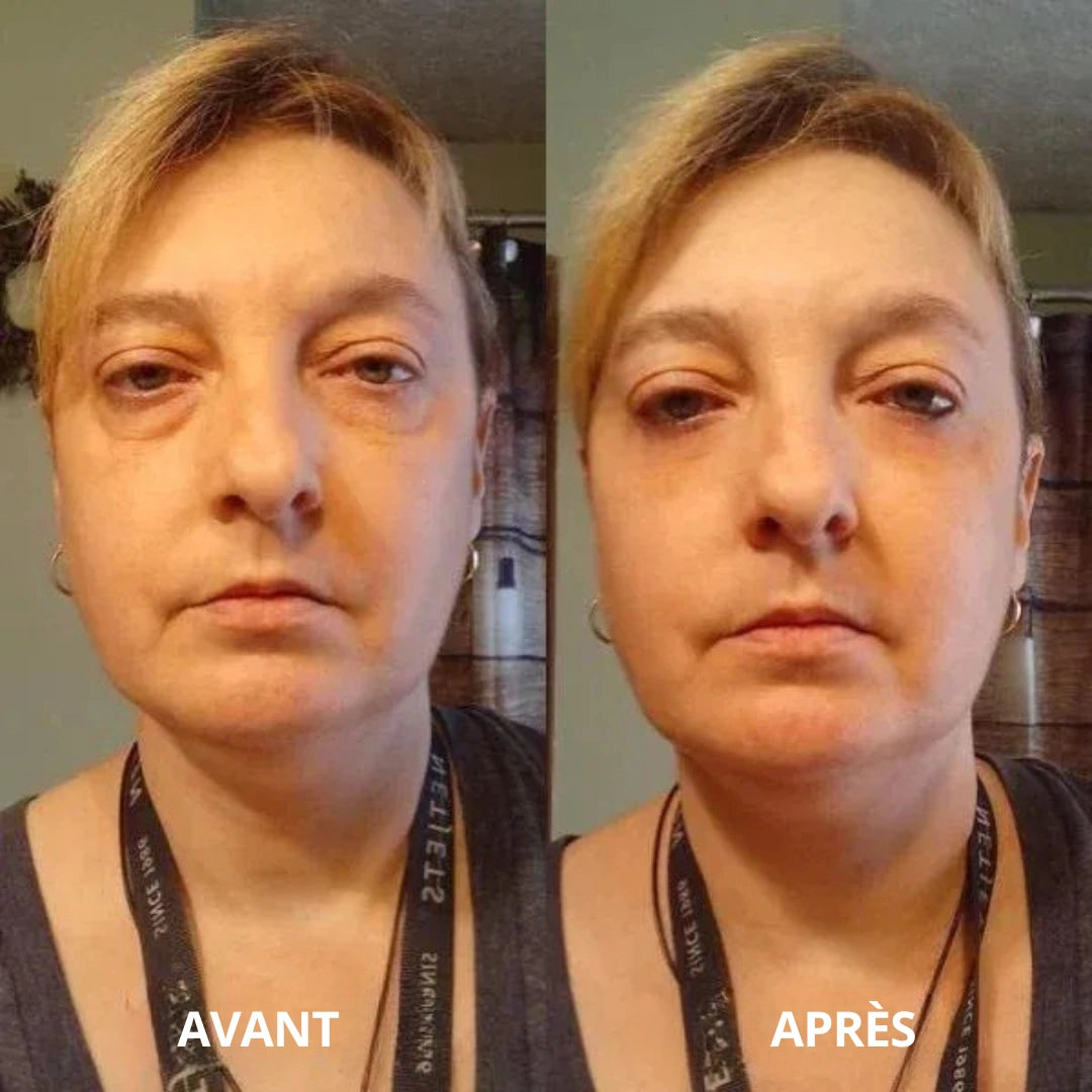 Patchs hydrogel SoilBoost au collagène et aux peptides