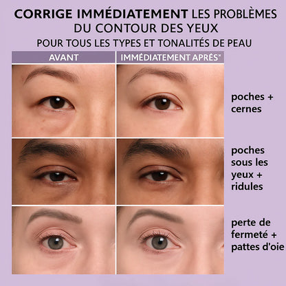 Soin anti-rides instantané