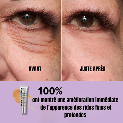 Soin anti-rides instantané