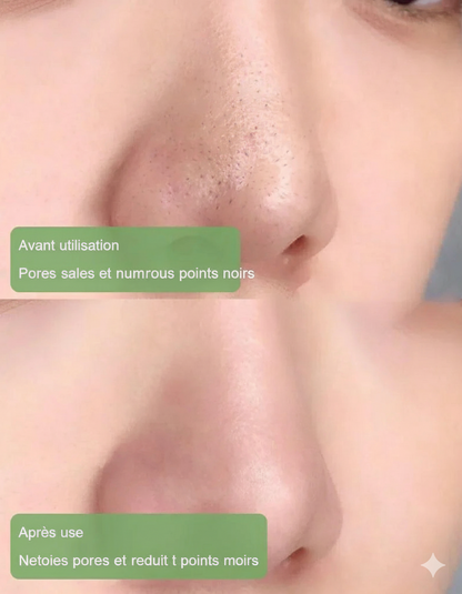 Masque purifiant antibactérien SoilBoost™ à l'extrait de thé vert