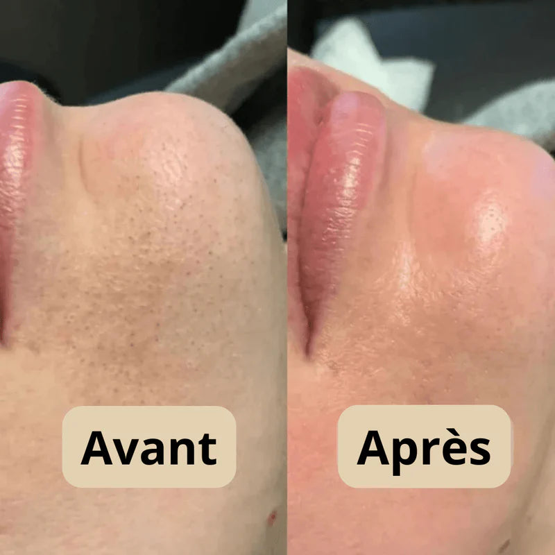 DERNIER JOUR 49% DE RÉDUCTION🔥 Duo d'Ampoules Peel Shot Glow au Riz