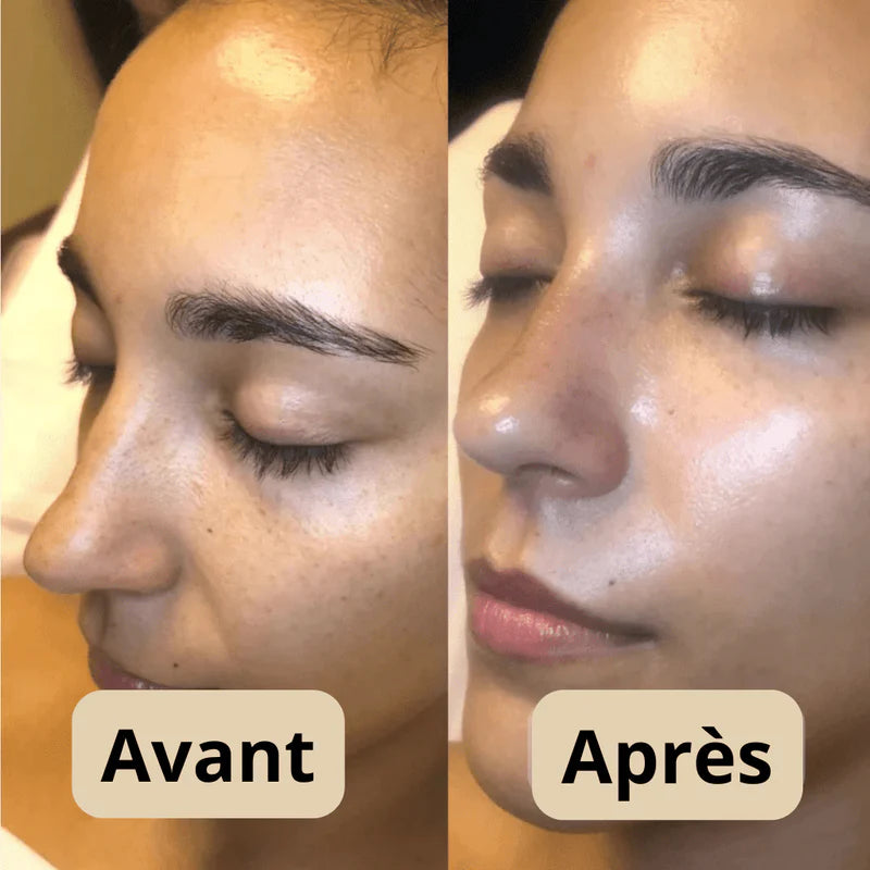 DERNIER JOUR 49% DE RÉDUCTION🔥 Duo d'Ampoules Peel Shot Glow au Riz