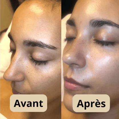 DERNIER JOUR 49% DE RÉDUCTION🔥 Duo d'Ampoules Peel Shot Glow au Riz