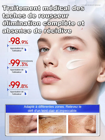 Crème éclaircissante anti-taches 377 !! Offrez à votre peau une clarté éclatante, révélez votre beauté naturelle dès maintenant !