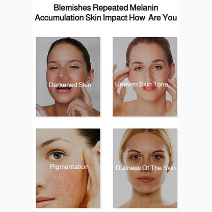 💥Spray éclaircissant et correcteur de taches pour un teint éclatant| Achetez 2，Obtenez 1 Gratuit 😍