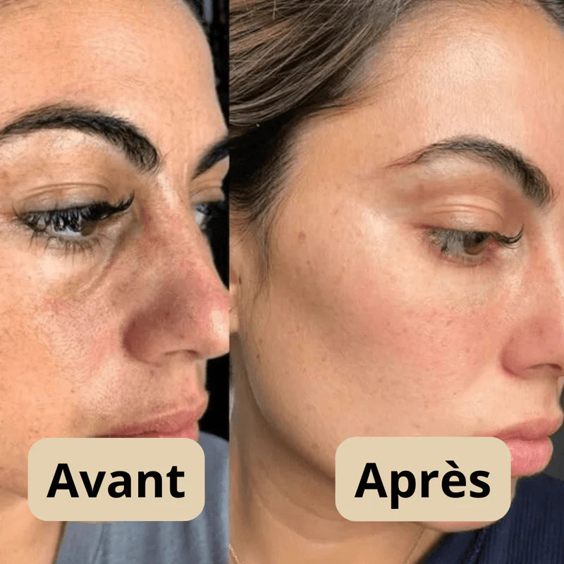 DERNIER JOUR 49% DE RÉDUCTION🔥 Duo d'Ampoules Peel Shot Glow au Riz