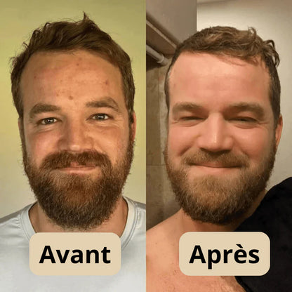 DERNIER JOUR 49% DE RÉDUCTION🔥 Duo d'Ampoules Peel Shot Glow au Riz