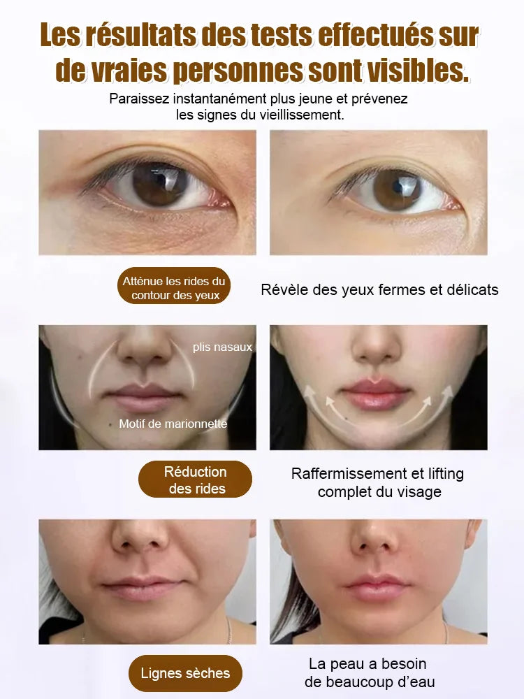 Sérum de collagène à recomposition cellulaire