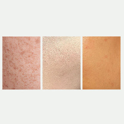 💥Spray éclaircissant et correcteur de taches pour un teint éclatant| Achetez 2，Obtenez 1 Gratuit 😍