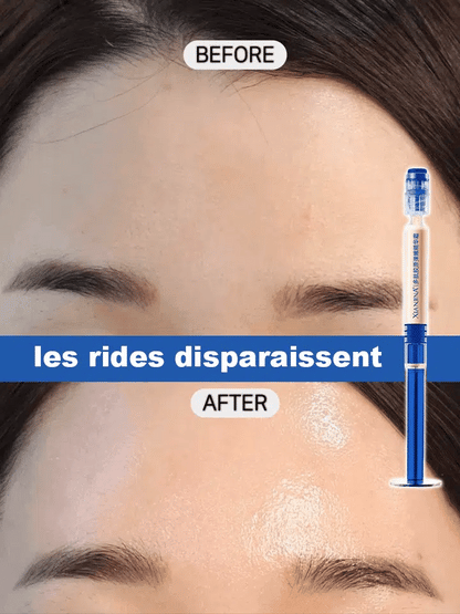 Crème de collagène de remplissage de tube d'aiguille de polypeptide