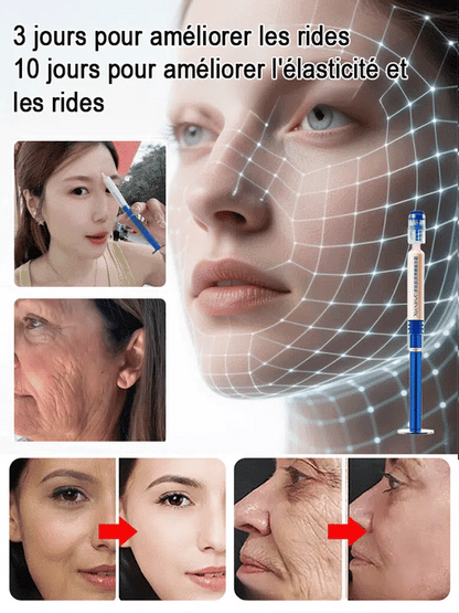 Crème de collagène de remplissage de tube d'aiguille de polypeptide
