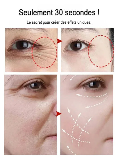 Crème de collagène de remplissage de tube d'aiguille de polypeptide