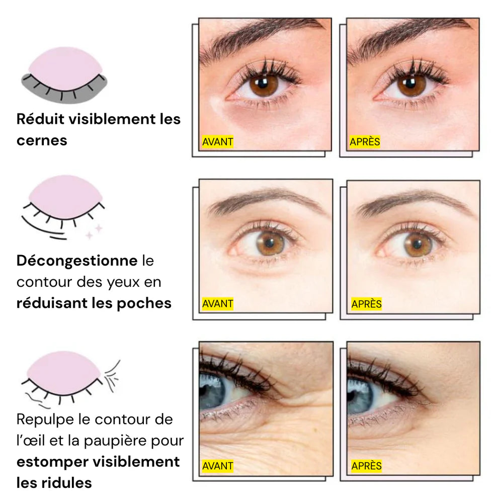 Patchs Yeux InstaLift au PDRN & Collagène