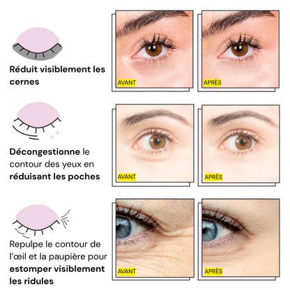 Patchs Yeux InstaLift au PDRN & Collagène