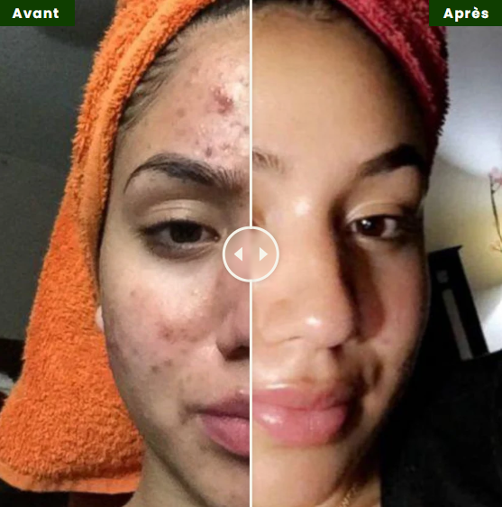 Savon Éclat au Curcuma