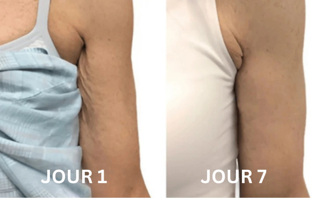 Elycura™ | Raffermit et affine la peau relâchée de 98 % en 24 heures