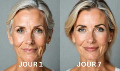 Elycura™ | Raffermit et affine la peau relâchée de 98 % en 24 heures