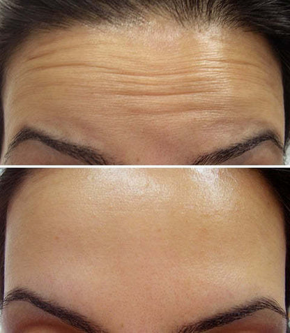 Lifting, raffermissement et éclat - Crème Celimax Retinal Glow boosting Cream