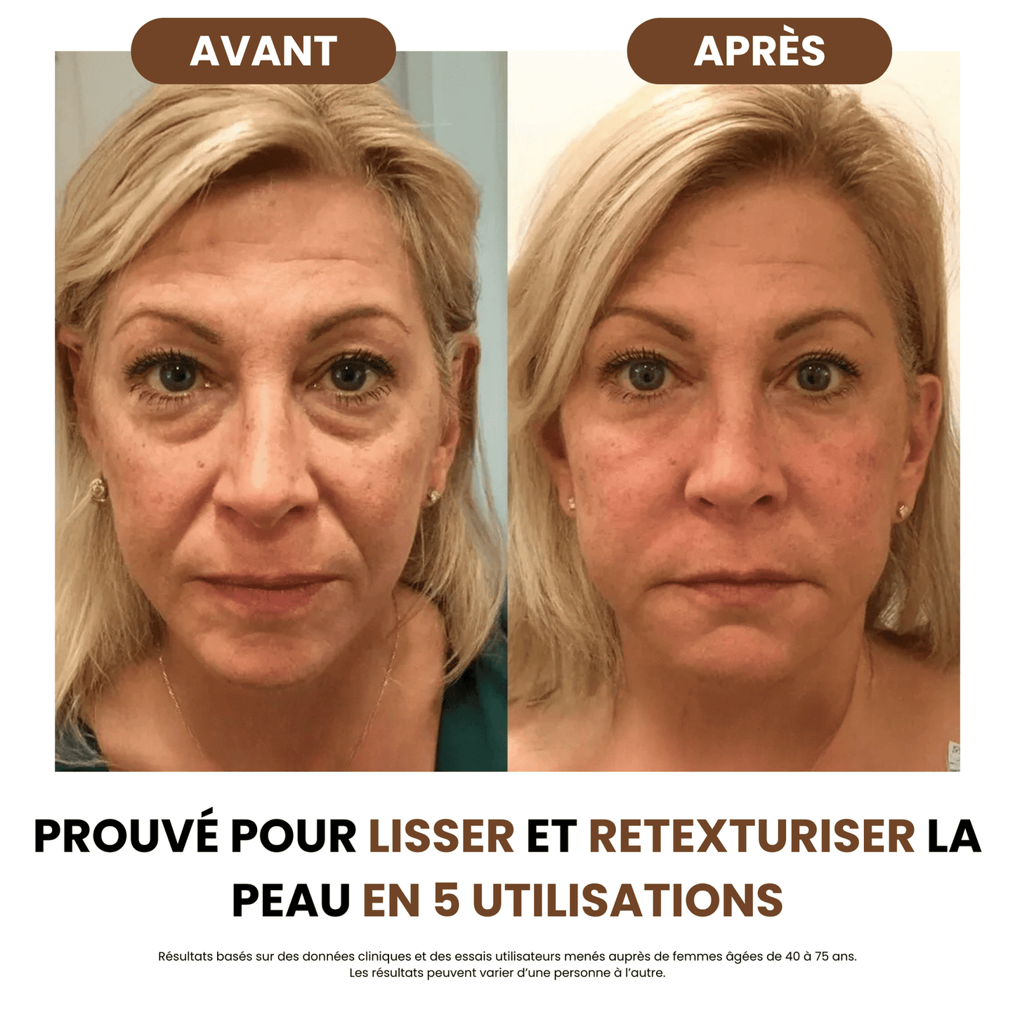 Brosse de drainage lymphatique SoilBoost