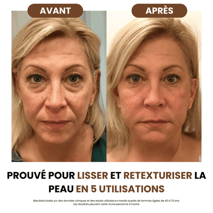 Brosse de drainage lymphatique SoilBoost