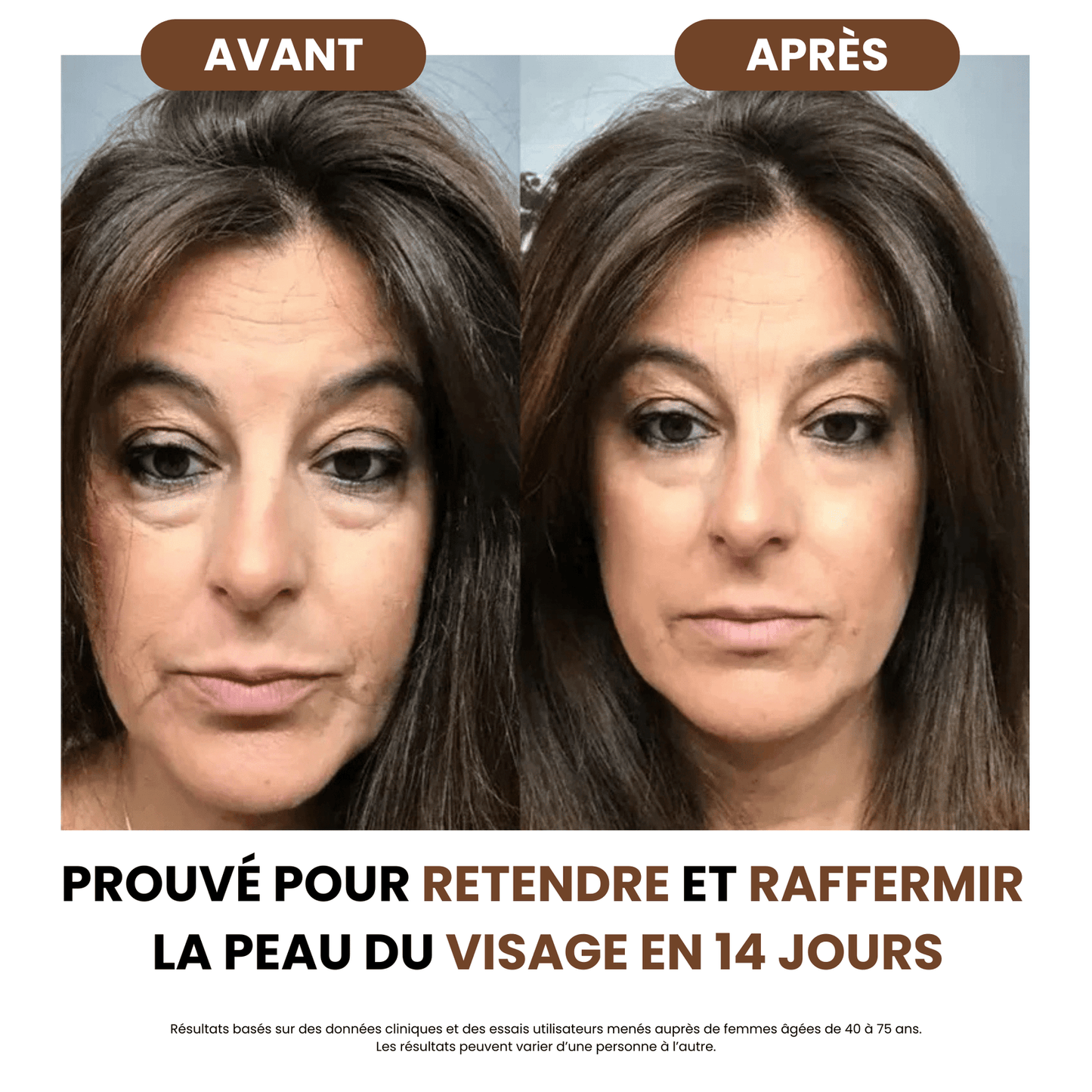 Brosse de drainage lymphatique SoilBoost