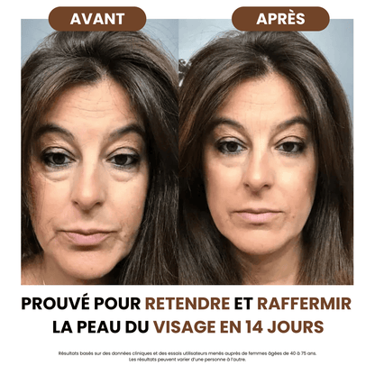 Brosse de drainage lymphatique SoilBoost