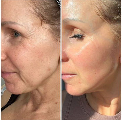 Ampoule Peptides de collagène pur - Lifting & Botox Naturel