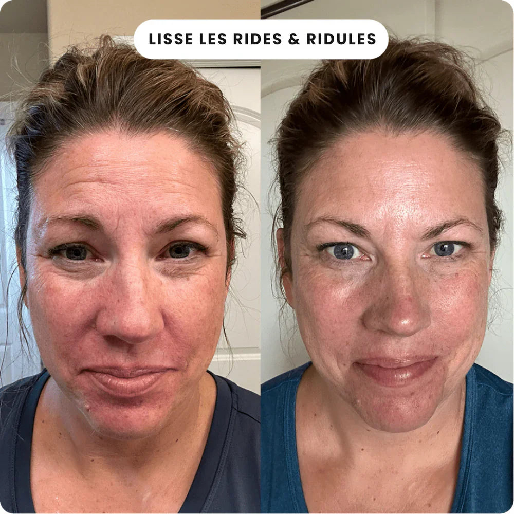 SoilBoost™ Micro-Infusion Lift Pro + Sérum extra offert