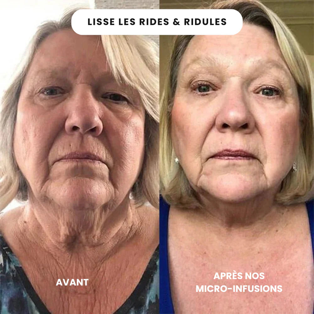 SoilBoost™ Micro-Infusion Lift Pro + Sérum extra offert