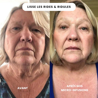 SoilBoost™ Micro-Infusion Lift Pro + Sérum extra offert
