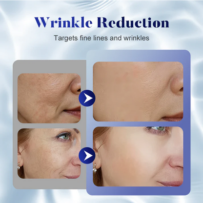 🌟 Crème Élégance Intemporelle ✨ – Formule avancée à base de peptides pour lisser les rides, raffermir la peau et redonner un éclat de jeunesse ! 🧬✨