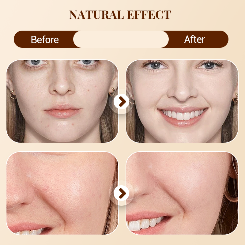 ⏳Spécial à durée limitée⏰Palette de 8 correcteurs crème matifiants doux🎨