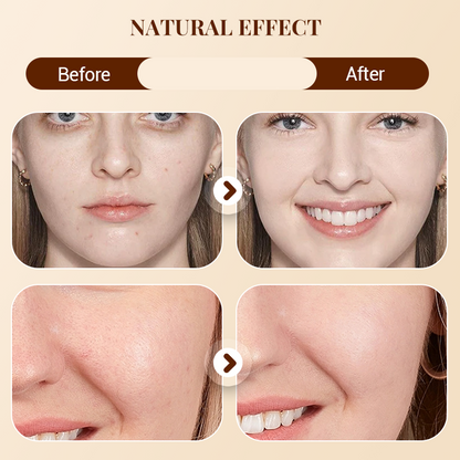 ⏳Spécial à durée limitée⏰Palette de 8 correcteurs crème matifiants doux🎨