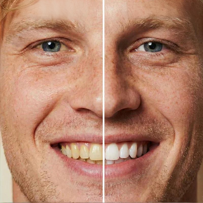 ⏳Spécial à durée limitée⏰Peinture dentaire blanchissante instantanée😁🦷